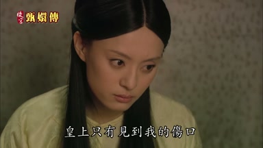 皇上只有見到我的傷口